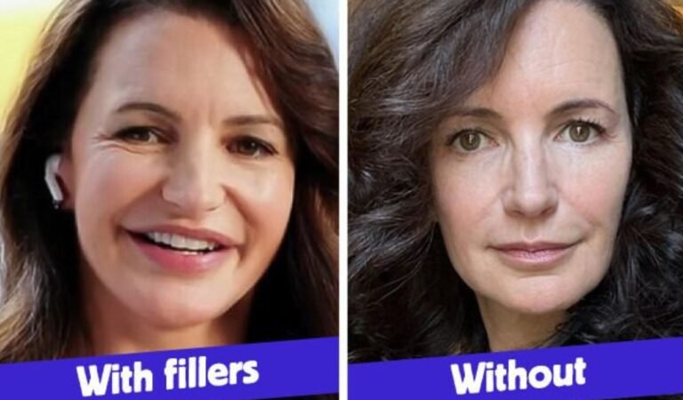Kristin Davis, 59, Dissolved Fillers in Her Face, Leaving People in Awe Kristin Davis, 59, Dissolved Fillers in Her Face, Leaving People in Awe