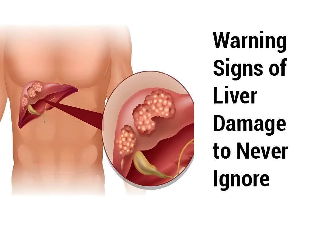 10 Red Flags That May Reveal Liver Toxicity|