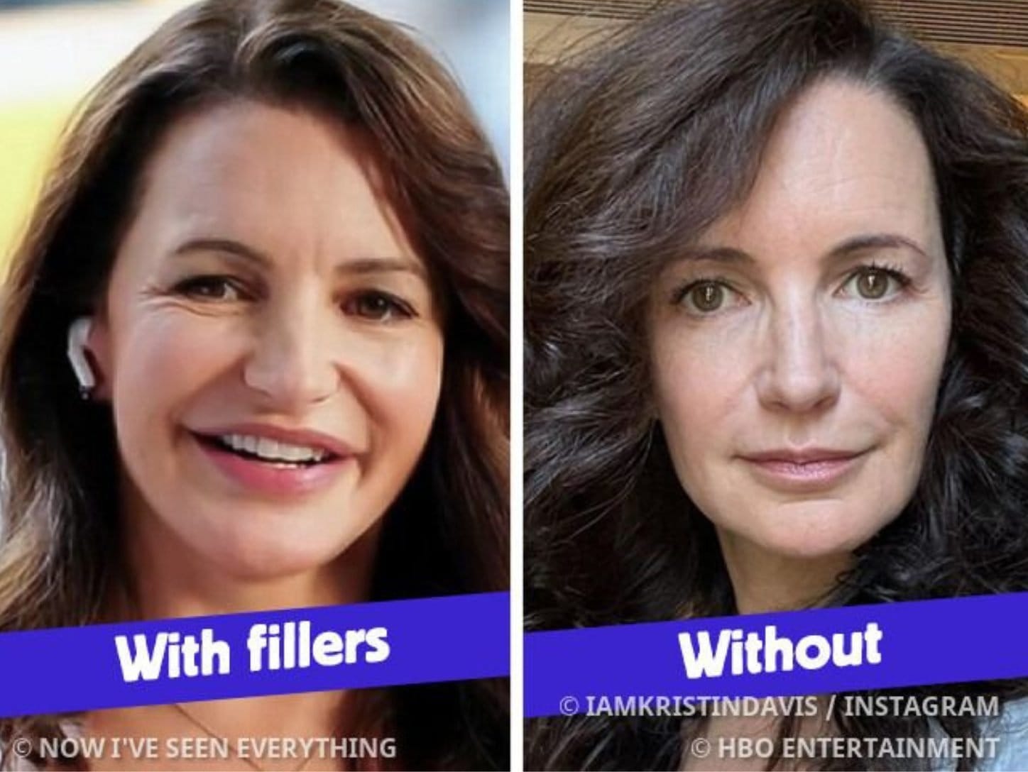 At 59, Kristin Davis Got Her Fillers Removed - And Everyone's Stunned by Her Look||||