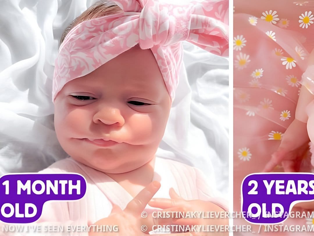 Girl Born With a Rare “Permanent Smile” — Only 14 People in the World Share This Condition||||||||||||