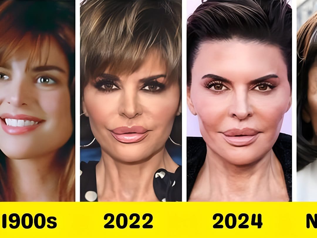 Lisa Rinna’s New Look at 61 Has Fans Shocked — “She’s Totally Unrecognizable!”|||||||Lisa Rinna’s New Look at 61 Has Fans Shocked — “She’s Totally Unrecognizable!”